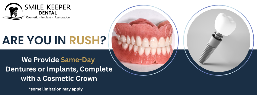 Same day Implant/Denture